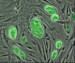 Léčba kmenovými buňkami. Neověřený zázrak vědy i poslední naděje nemocných