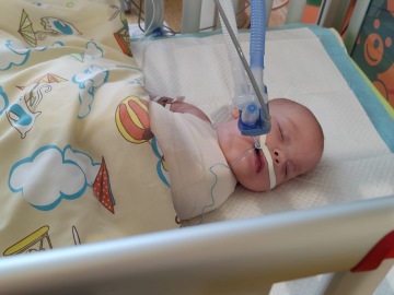 Aby Andreásek neměl postižení celý život: zachraňme jeho ručičku