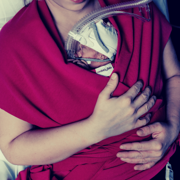 maminka s předčasně narozeným miminkem ve speciálním vaku